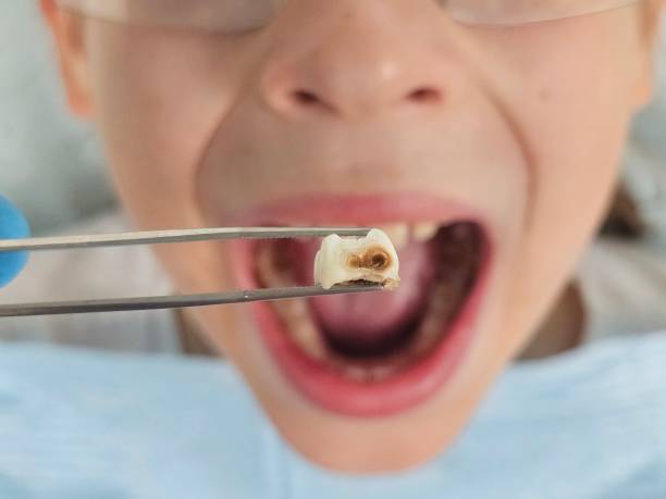 Best Knocked-Out Tooth Emergency  in Whitley City, KY