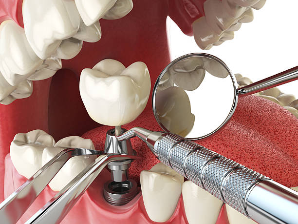 Best Urgent Tooth Repair  in Whitley City, KY