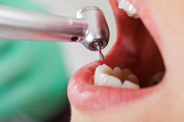 Best Dentist for Tooth Abscess  in Whitley City, KY